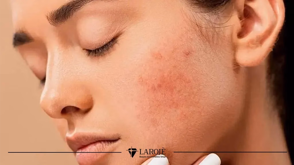 Cerave یا اوردینری