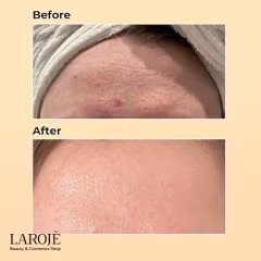 اسنس حلزون کوزارکس Cosrx (ترمیم کننده و جوانساز) - تصویر ۵