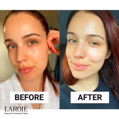 کرم آبرسان و ضدجوش لاروش پوزای La Roche Posay با SPF30 - تصویر ۴