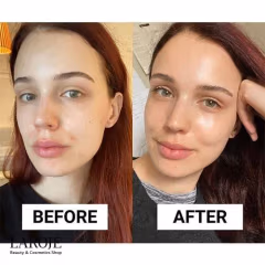 کرم آبرسان و ضدجوش لاروش پوزای La Roche Posay با SPF30 - تصویر ۳