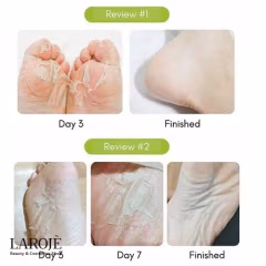 ماسک لایه بردار پا پیوردرم Purederm - تصویر ۳
