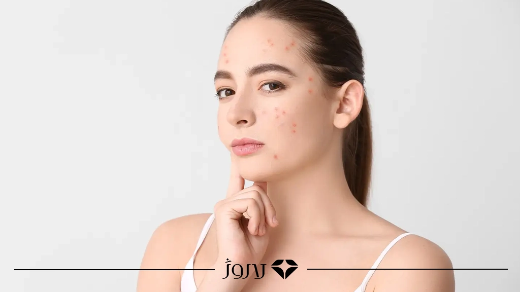 آرایش روی پوست آمادهنشده