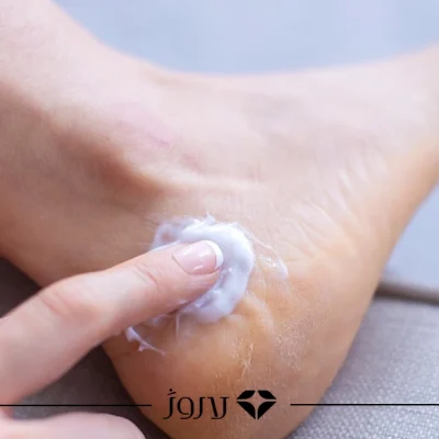 درمان ترک پا در خانه