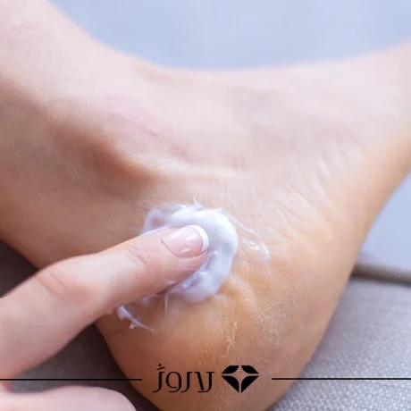 درمان ترک پا در خانه